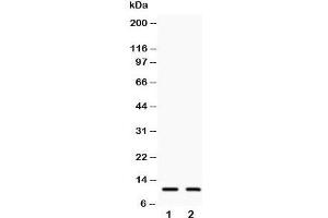 Western blot testing of Eotaxin 3 antibody and Lane 1:  COLO320;  2: A549;  Predicted size: 11KD;  Observed size: 11KD (CCL26 antibody  (C-Term))