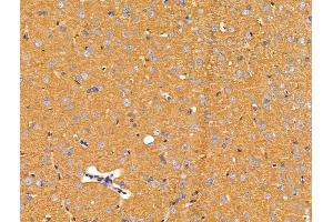 ABIN7094708 and ABIN7098759 at 1/100 staining Rat brain tissue by IHC-P. (ACTR1A antibody  (Internal Region))