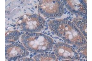 Detection of IL4 in Rat Intestine Tissue using Monoclonal Antibody to Interleukin 4 (IL4) (IL-4 antibody  (AA 61-111))
