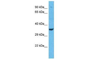 Western Blotting (WB) image for anti-Olfactory Receptor, Family 1, Subfamily L, Member 1 (OR1L1) (N-Term) antibody (ABIN2791714) (OR1L1 antibody  (N-Term))