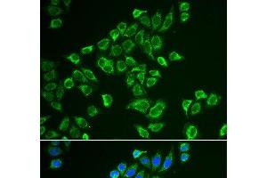 Immunofluorescence analysis of HeLa cells using TAGLN Polyclonal Antibody (Transgelin antibody)