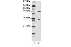 Image no. 2 for anti-PHD Finger Protein 1 (PHF1) (AA 421-470) antibody (ABIN202770)