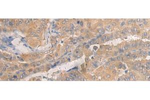 AGAP3 antibody