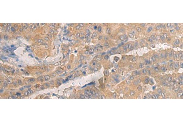 AGAP3 antibody
