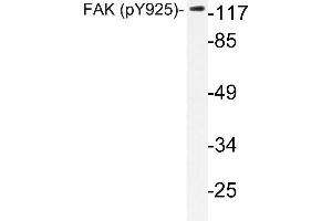Western blot (WB) analyzes of p-FAK antibody in extracts from HepG2 cells. (FAK antibody  (pTyr925))