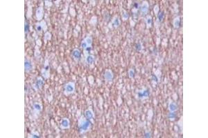 Figure. (CBLN1 antibody  (AA 22-193))