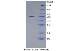 SDS-PAGE (SDS) image for Spondin 2 (SPON2) (AA 119-330) protein (His tag) (ABIN1879760) (SPON2 Protein (AA 119-330) (His tag))