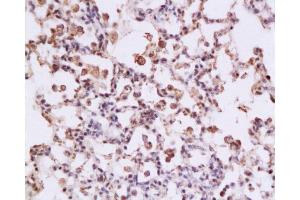 Formalin-fixed and paraffin embedded rat lung tissue labeled with Anti-STAT3 Polyclonal Antibody, Unconjugated at 1:200 followed by conjugation to the secondary antibody , (SP-0023), and DAB staining (STAT3 antibody  (AA 233-330))