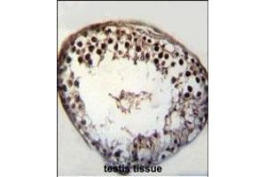 BRSK1 Antibody (C-term) (ABIN652432 and ABIN2842239) immunohistochemistry analysis in formalin fixed and paraffin embedded human testis tissue followed by peroxidase conjugation of the secondary antibody and DAB staining. (BRSK1 antibody  (C-Term))