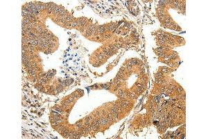 Immunohistochemistry (IHC) image for anti-Solute Carrier Family 32 (GABA Vesicular Transporter), Member 1 (SLC32A1) antibody (ABIN3023496) (SLC32A1 antibody)
