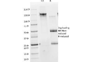 SDS-PAGE Analysis Purified Cytokeratin 10 Monoclonal Antibody (DE-K10). (Keratin 10 antibody)