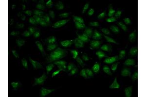 Immunofluorescence analysis of HeLa cell using YWHAB antibody. (YWHAB antibody)