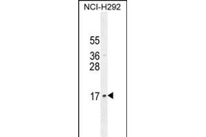 LLPH Antibody (Center) (ABIN654797 and ABIN2844474) western blot analysis in NCI- cell line lysates (35 μg/lane). (LLPH antibody  (AA 62-90))