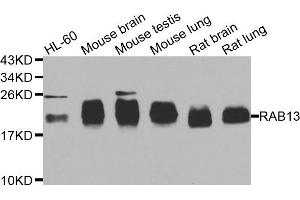 Western blot analysis of extracts of various cell lines, using RAB31 antibody. (RAB31 antibody)