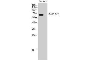 Western Blotting (WB) image for anti-CstF-64T (Internal Region) antibody (ABIN3180563) (CstF-64T (Internal Region) antibody)