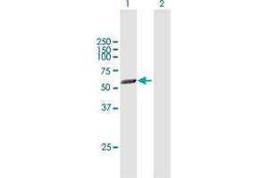 Western Blot analysis of PICK1 expression in transfected 293T cell line by PICK1 MaxPab polyclonal antibody. (PICK1 antibody  (AA 1-415))