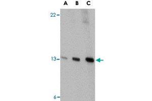 Western blot analysis of PSENEN in K-562 cell lysate with PSENEN polyclonal antibody  at (A) 0. (PEN2 antibody  (C-Term))