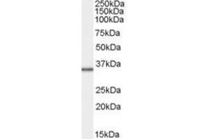 Image no. 1 for anti-Mitochondrial Ribosomal Protein L3 (MRPL3) (C-Term) antibody (ABIN374279) (MRPL3 antibody  (C-Term))