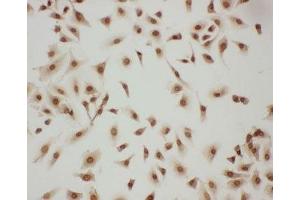 ICC testing of LASP1 antibody and A549 cells (LASP1 antibody  (AA 16-30))