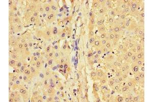 Immunohistochemistry of paraffin-embedded human liver tissue using ABIN7153605 at dilution of 1:100 (GJB1 antibody  (AA 215-283))