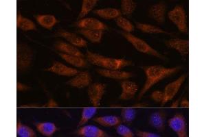 Immunofluorescence analysis of L929 cells using UNC13B Polyclonal Antibody at dilution of 1:100. (UNC13B antibody)
