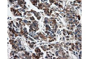 Immunohistochemistry (IHC) image for anti-Fumarylacetoacetate Hydrolase Domain Containing 2A (FAHD2A) antibody (ABIN1498182) (FAHD2A antibody)