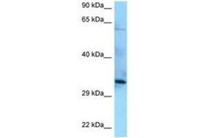 Image no. 1 for anti-Protein Phosphatase 6, Catalytic Subunit (PPP6C) (AA 90-139) antibody (ABIN6748166) (PPP6C antibody  (AA 90-139))