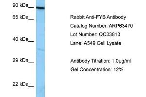 Western Blotting (WB) image for anti-FYN-Binding Protein (FYB) (C-Term) antibody (ABIN2789512) (FYB antibody  (C-Term))