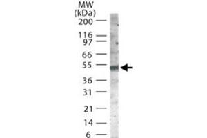 Western blot analysis of SMAD6 in 30 ug of Jurkat cell lysate using SMAD6 polyclonal antibody  at 2 ug/mL . (SMAD6 antibody  (AA 85-99))