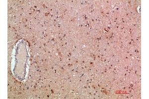 Immunohistochemical analysis of paraffin-embedded human-brain, antibody was diluted at 1:200 (MLL/KMT2A antibody  (AA 3850-3900))