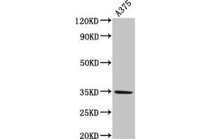 Western Blot Positive WB detected in: A375 whole cell lysate All lanes: MC1R antibody at 4 μg/mL Secondary Goat polyclonal to rabbit IgG at 1/50000 dilution Predicted band size: 35 kDa Observed band size: 35 kDa (MC1 Receptor antibody  (AA 1-37))
