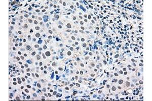Image no. 2 for anti-Mitogen-Activated Protein Kinase 1 (MAPK1) antibody (ABIN1499287) (ERK2 antibody)