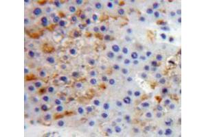 Used in DAB staining on fromalin fixed paraffin-embedded Liver tissue (PTPRS antibody  (AA 77-361))