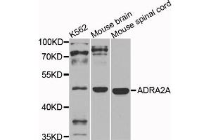Western blot analysis of extracts of various cell lines, using ADRA2A antibody. (ADRA2A antibody)