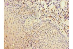 Immunohistochemistry of paraffin-embedded human tonsil tissue using ABIN7148407 at dilution of 1:100 (CD35 antibody  (AA 420-550))