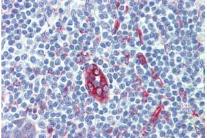 Human Tonsil (formalin-fixed, paraffin-embedded) stained with SERPINH1 antibody ABIN462363 followed by biotinylated anti-mouse IgG secondary antibody ABIN481714, alkaline phosphatase-streptavidin and chromogen. (SERPINH1 antibody)