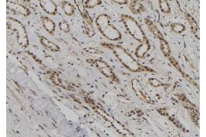 ABIN6260330 and ABIN6276872 at 1/100 staining Human kidney tissue by IHC-P. (BUB1B antibody  (C-Term))