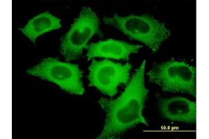 Immunofluorescence of monoclonal antibody to TIPIN on HeLa cell. (TIPIN antibody  (AA 1-301))