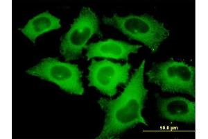 Immunofluorescence of monoclonal antibody to TIPIN on HeLa cell.
