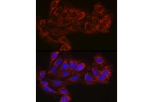Immunofluorescence analysis of U-2 OS cells using EIF4E2 Rabbit pAb (ABIN6130366, ABIN6140086, ABIN6140087 and ABIN6220578) at dilution of 1:100 (40x lens). (EIF4E2 antibody  (AA 1-240))