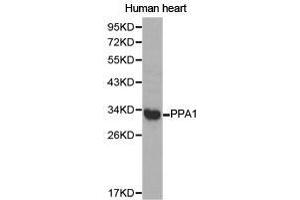 Western Blotting (WB) image for anti-Pyrophosphatase (Inorganic) 1 (PPA1) antibody (ABIN1874203) (Pyrophosphatase (Inorganic) 1 (PPA1) antibody)