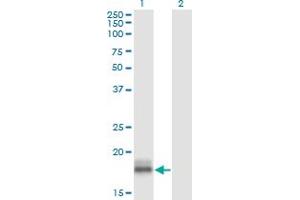 Western Blot analysis of LMO2 expression in transfected 293T cell line by LMO2 monoclonal antibody (M01), clone 6B8.