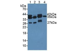 Figure. (PDXK antibody  (AA 35-251))