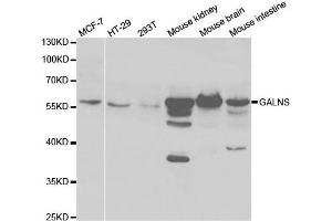 Western Blotting (WB) image for anti-Galactosamine (N-Acetyl)-6-Sulfate Sulfatase (GALNS) antibody (ABIN1876649) (GALNS antibody)