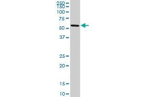 Western Blotting (WB) image for anti-Oxidative-Stress Responsive 1 (OXSR1) (AA 1-528) antibody (ABIN599106) (OXSR1 antibody  (AA 1-528))