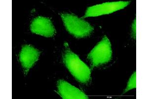 Immunofluorescence of purified MaxPab antibody to PTK2B on HeLa cell. (PTK2B antibody  (AA 1-1009))