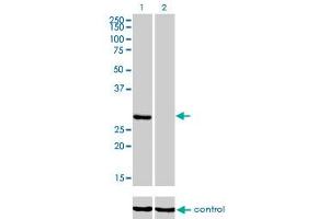 Western Blotting (WB) image for anti-Ketohexokinase (KHK) (AA 1-299) antibody (ABIN598769) (Ketohexokinase antibody  (AA 1-299))