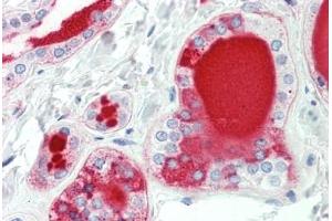 Human Thyroid: Formalin-Fixed, Paraffin-Embedded (FFPE) (HAS3 antibody  (AA 137-164))