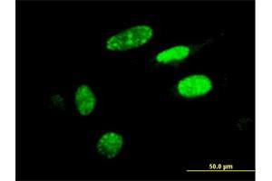 Immunofluorescence of monoclonal antibody to HIC1 on HeLa cell. (HIC1 antibody  (AA 396-453))