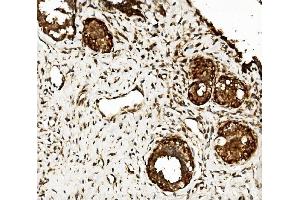 IHC analysis of CLPB using anti-CLPB antibody (ABIN7601732). (CLPB antibody  (AA 438-707))
